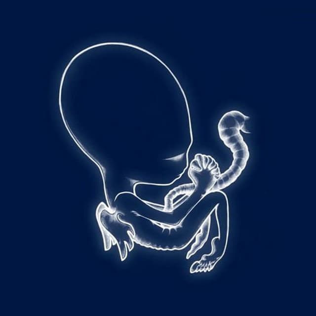 Release Cover Sigur Rós - Ágætis byrjun
